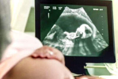 USG kobiety w ciąży. Widać ekran i brzuch.